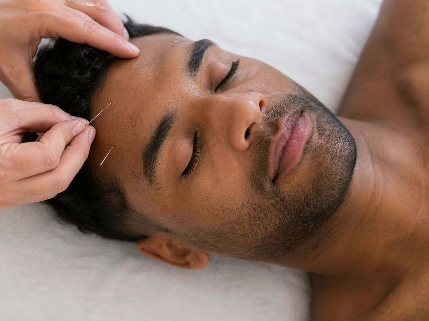 Acupuncture for stress, anxiety and depression in Cape Town