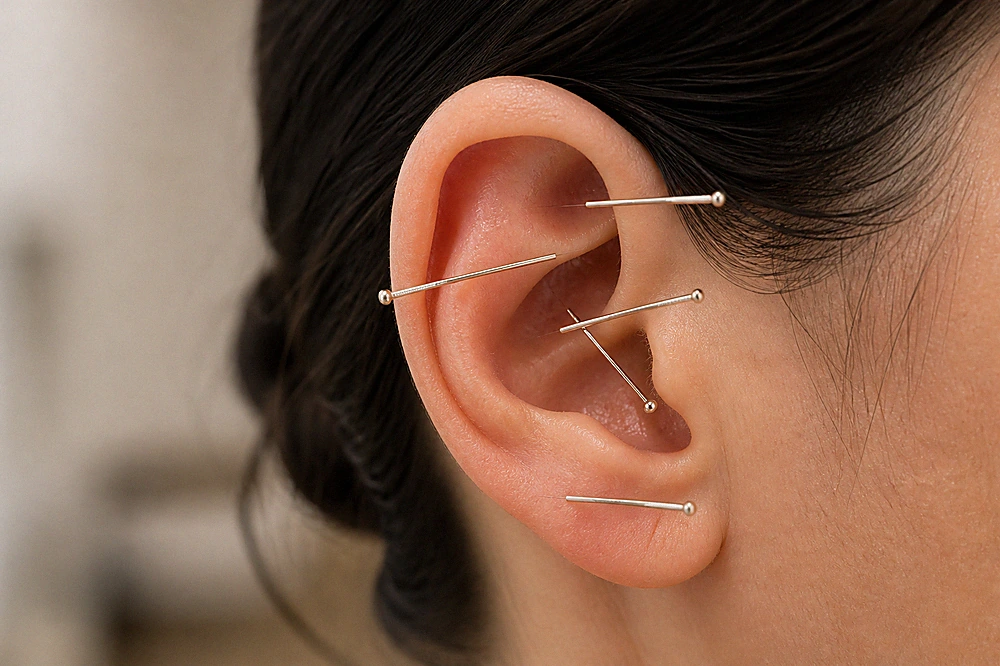 Ear acupuncture for addiction and stress support in Cape Town