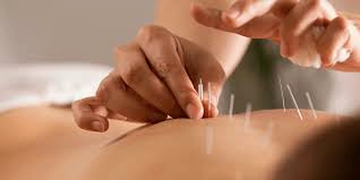 Acupuncture for chronic conditions including diabetes and high blood pressure in Cape Town