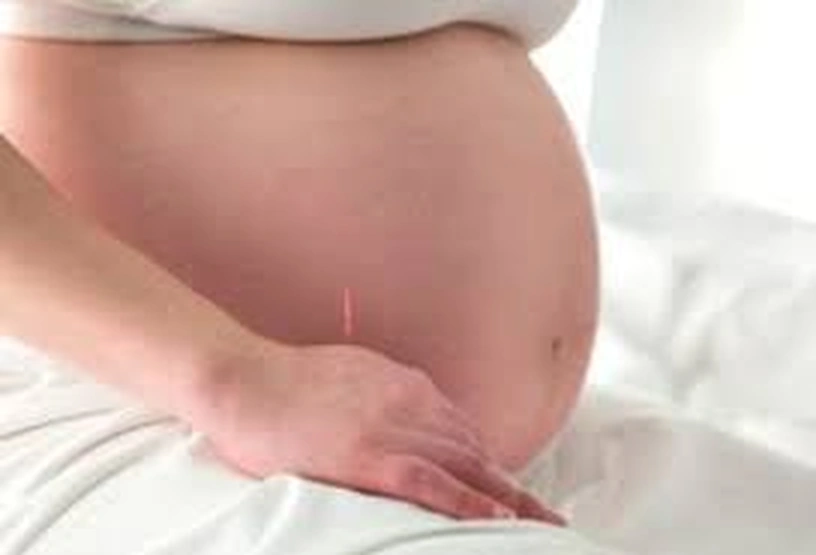 Pregnancy acupuncture and induction support Cape Town