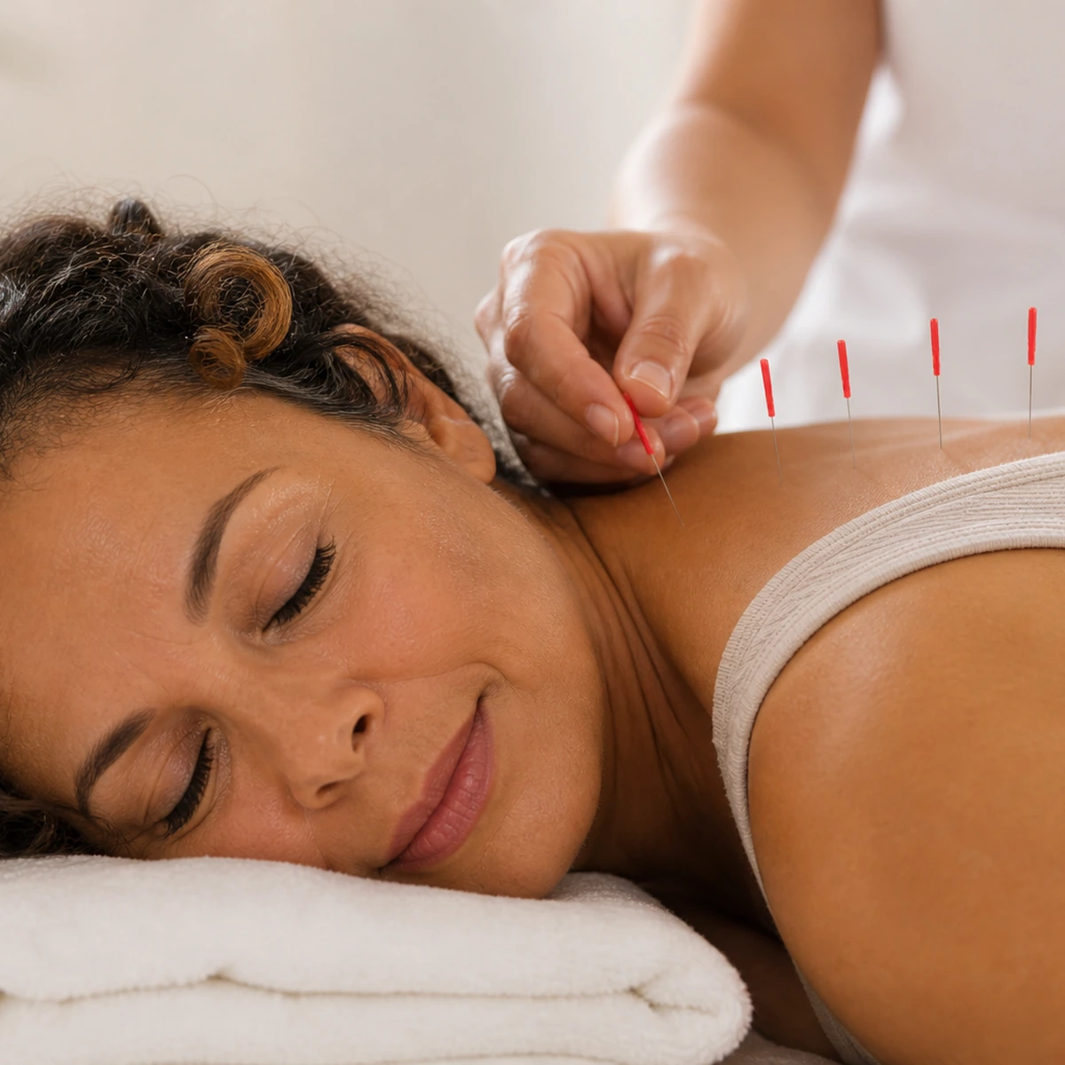 Menopause acupuncture support in Cape Town